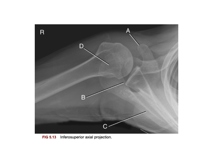 Axial Projection Example Radiology Inferosuperior axial shoulder projection. Quiz