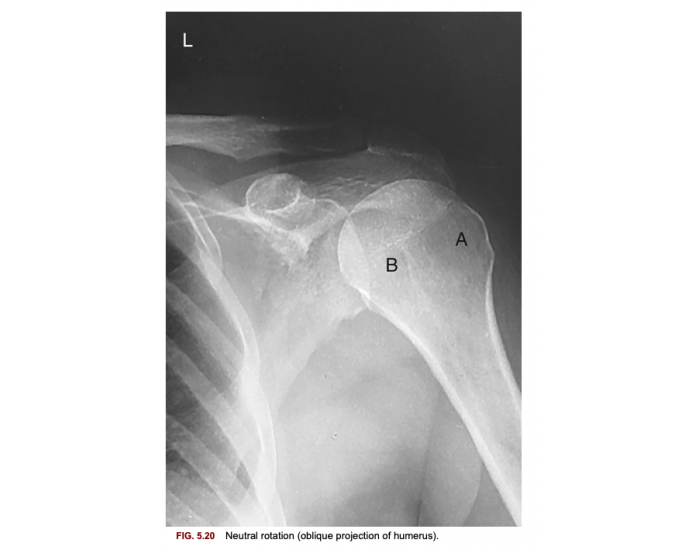 Neutral rotation (oblique projection of humerus) Quiz