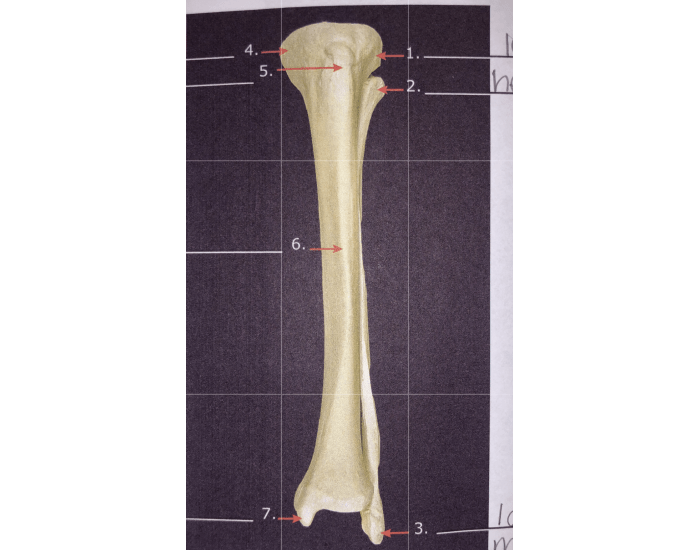 Tibia Starting View tibia and fibula, anterior views (real) Quiz