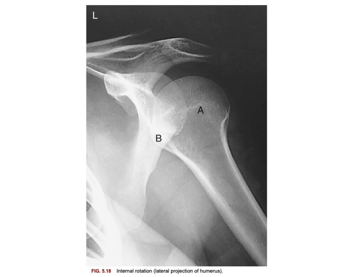 External Rotation Humerus External rotation (AP projection of humerus). Quiz