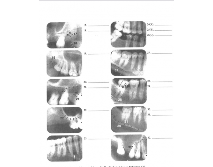 normal radiographs Quiz