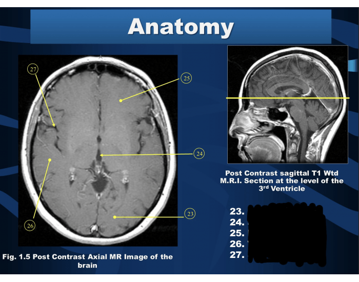 Mri Brain 5 Quiz Mri Brain 5 Quiz