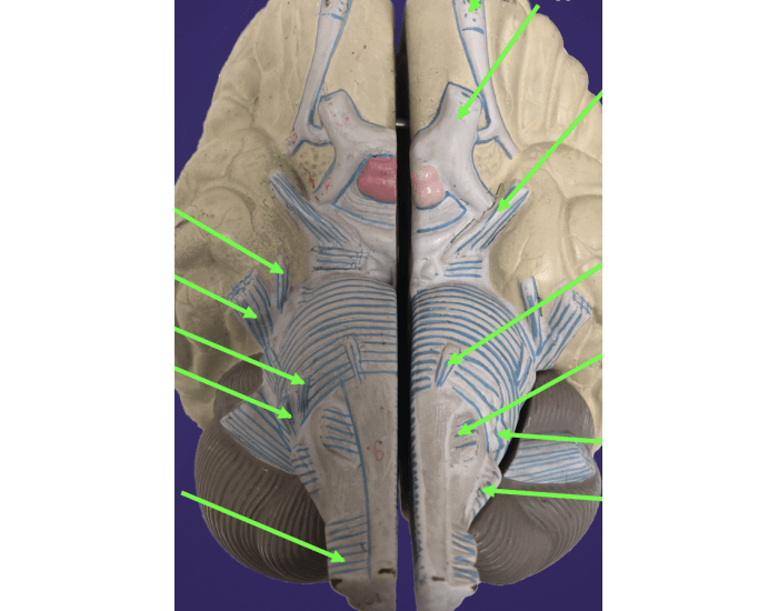 Cranial Nerves Quiz Cranial nerves quiz