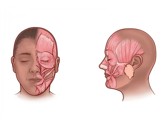 anterior-of-facial-and-side-of-head-quiz