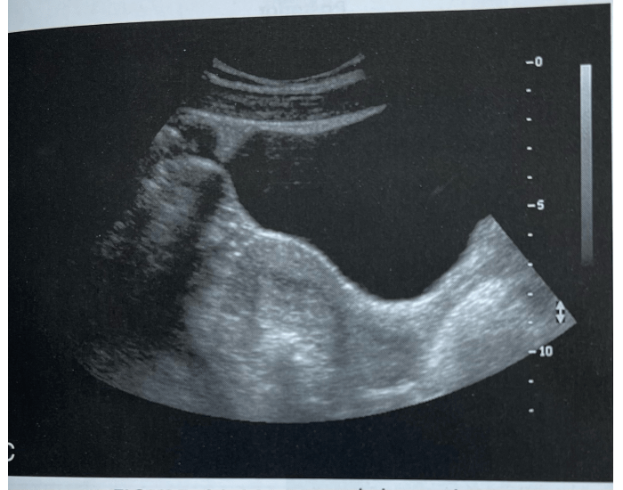 fig-20-23-long-pelvic-image-ultrasound-c-printable-worksheet