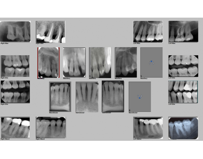 Full Mouth Series Quiz