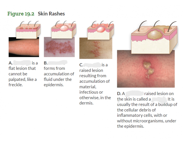 Types of skin lesions Quiz