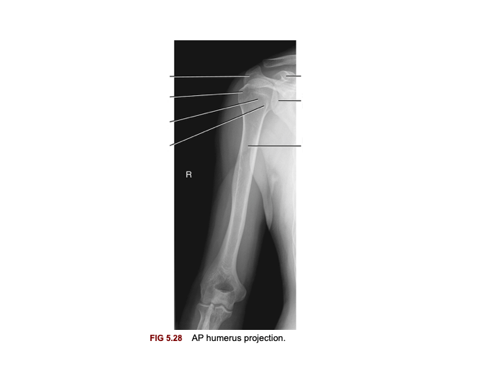 Normal Ap Humerus AP humerus projection Quiz