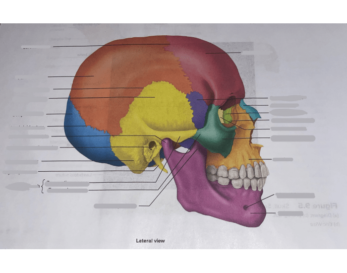 Skull Quiz
