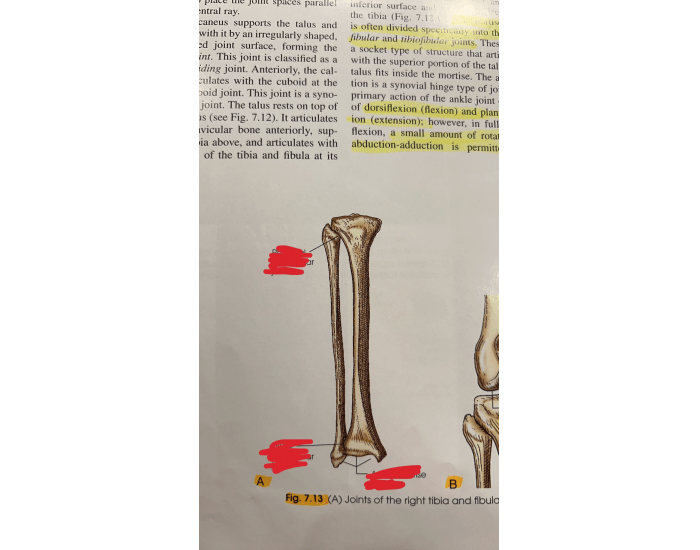 Leg Quiz