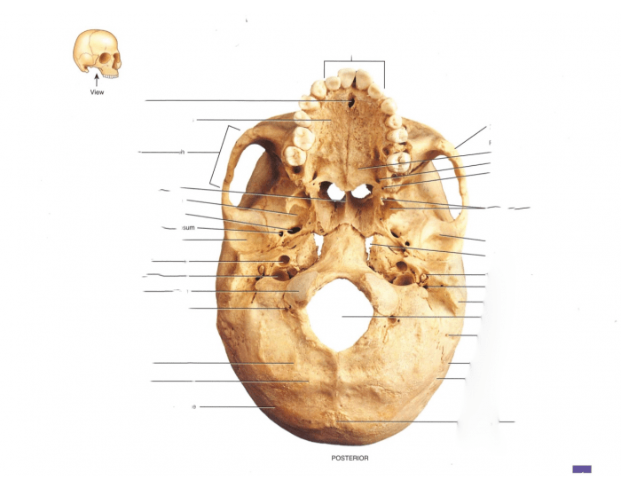 Under View Skull under view Quiz
