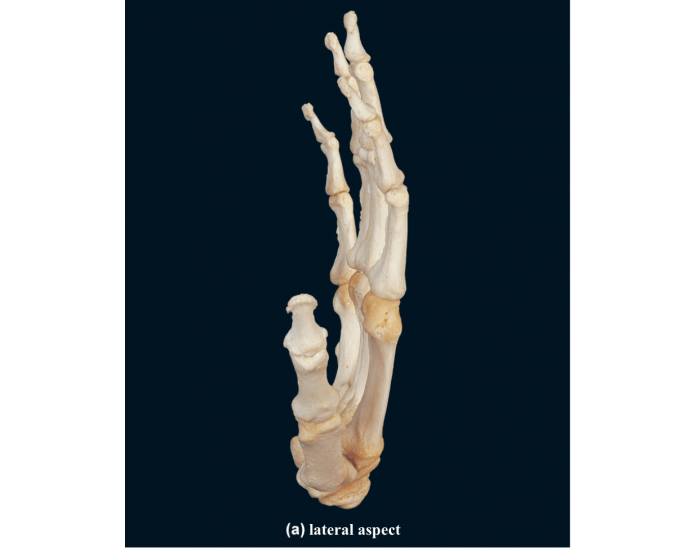 Lateral view of hand bones Quiz