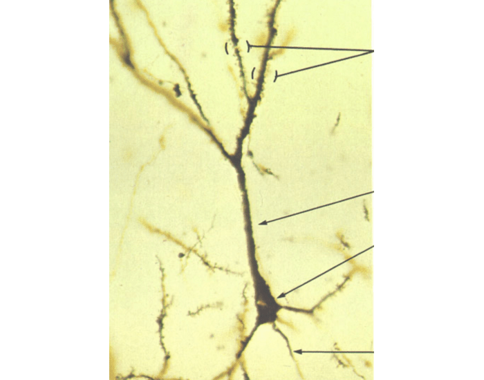 Pyramidal Cells Microscope Pyramidal Cell Histology 1 (from Cerebral Cortex) Quiz