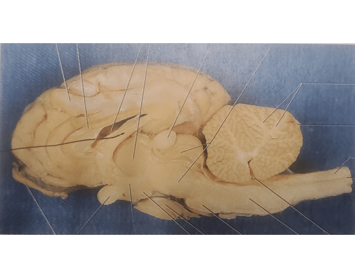 Brain Labeled Disection Brain dissection labeling — Printable Worksheet