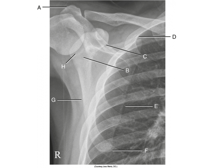 Bone Labelling Chest AP chest x-ray labeling anatomy — Printable Worksheet