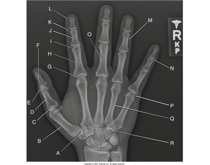 PA hand labeling (Anatomy Testing 1) — Printable Worksheet