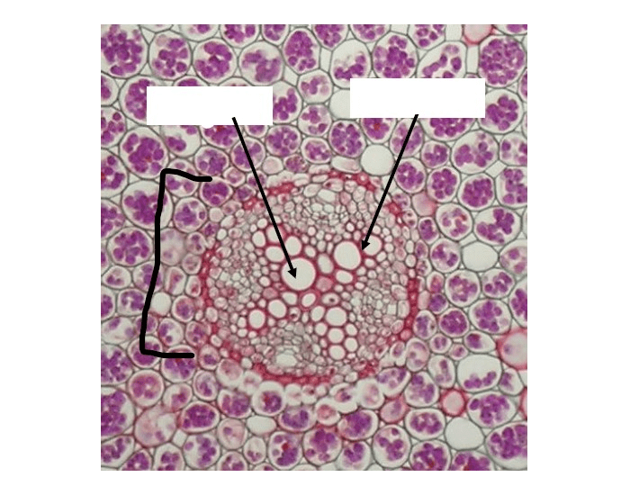 Codit Xylem Dicot Root Xylem Types Quiz