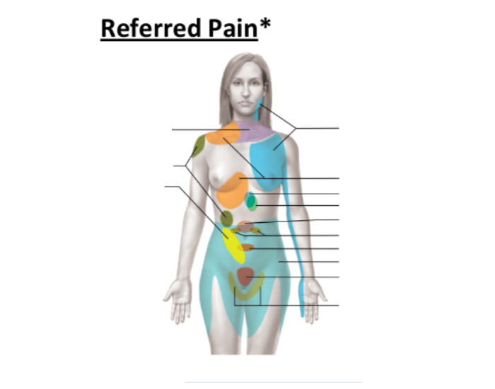 Organ Radiating Pain Referred pain for visceral organs — Printable Worksheet