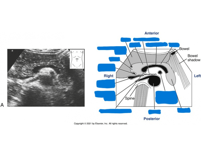 Double Sac Sign — Printable Worksheet