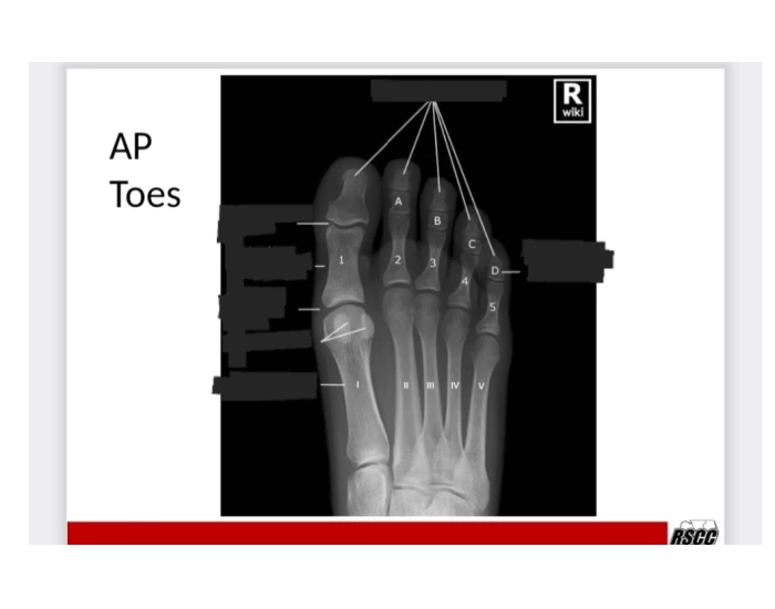 Ap toes Quiz