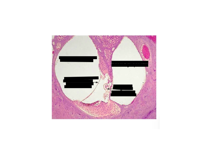 External Ear Micrograph Ear Diagram Under Microscope Quiz