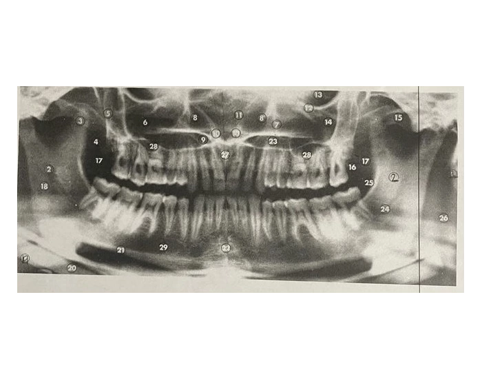 Panorex radiograph practice — Printable Worksheet