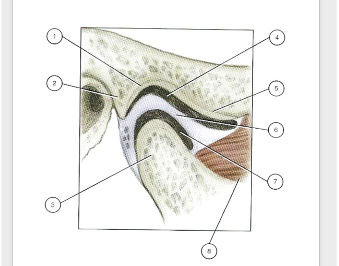 TMJ Sagittal view — Printable Worksheet