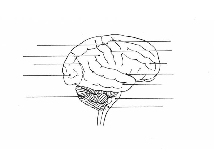 Brain Lateral View Quiz