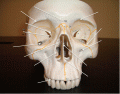Bones of the Skull (Frontal View