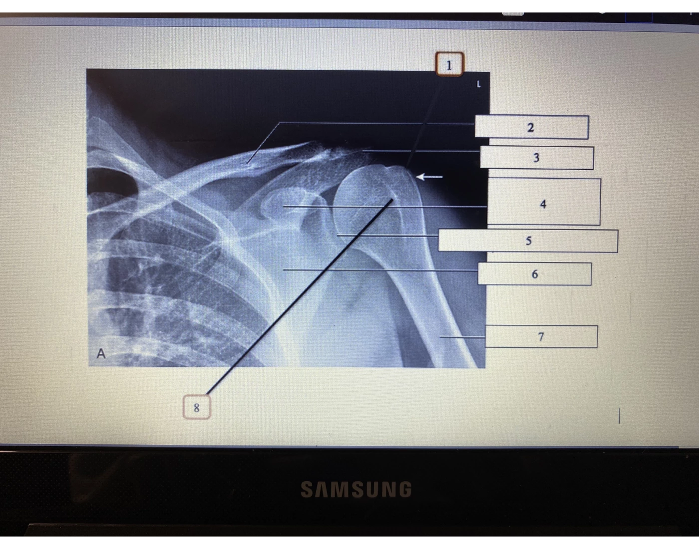 Shoulder Anatomy Quiz
