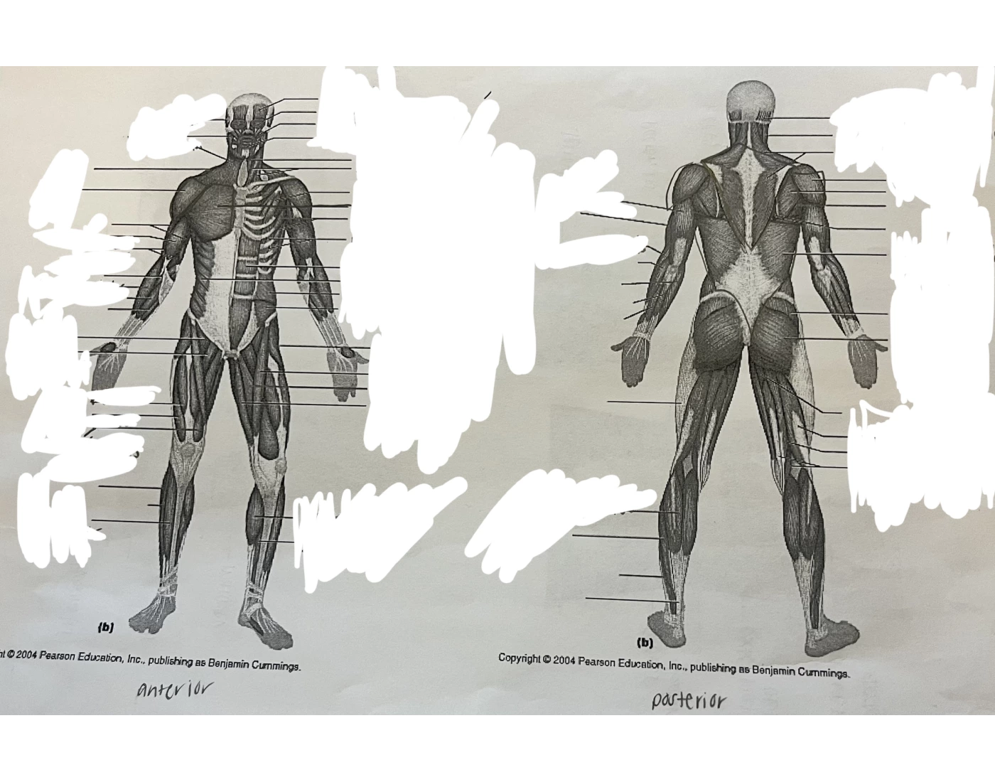 Muscle Identification Quiz