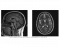 MRI Imaging. T1 or T2? 