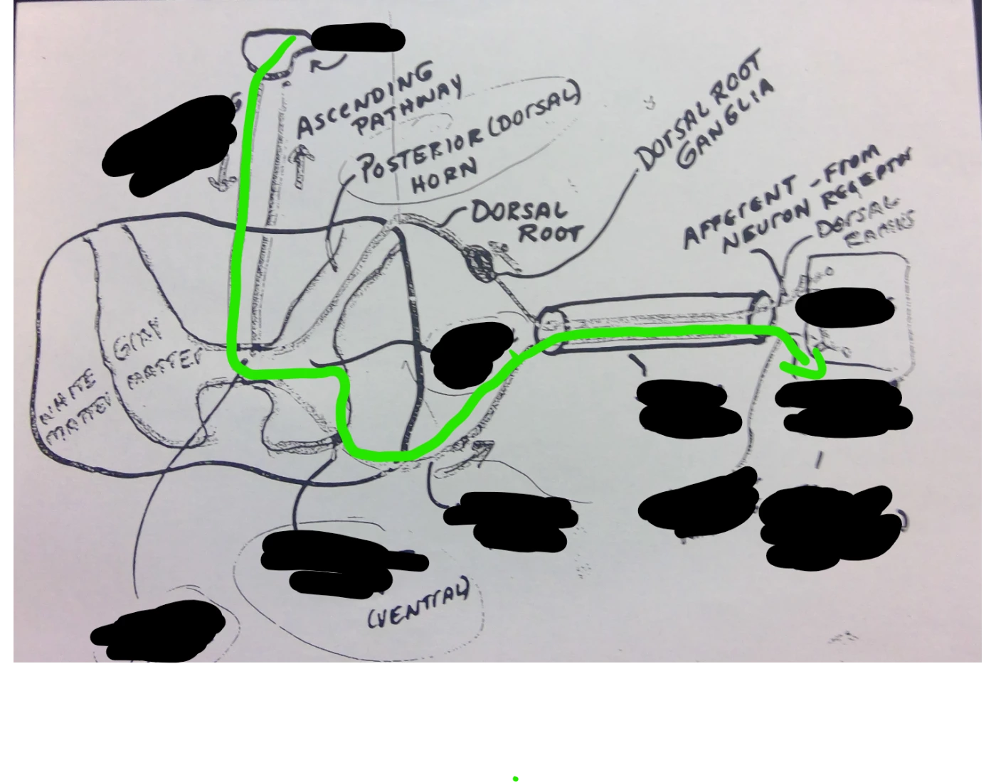 Descending (motor) pathways Quiz