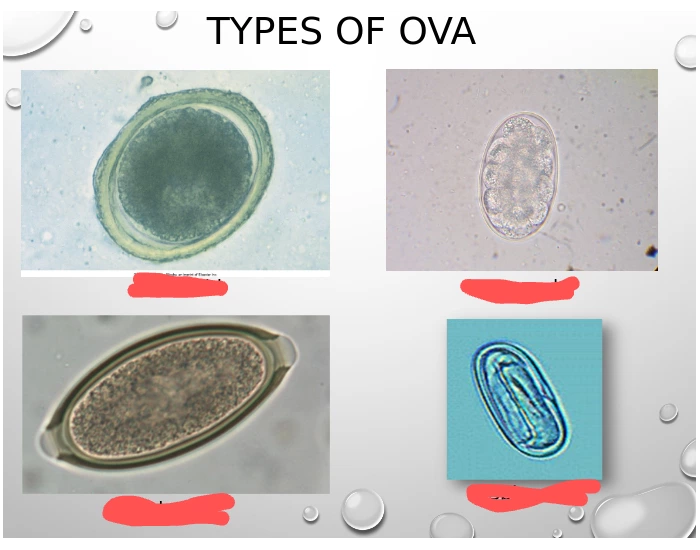 Type Ova types of ova Quiz