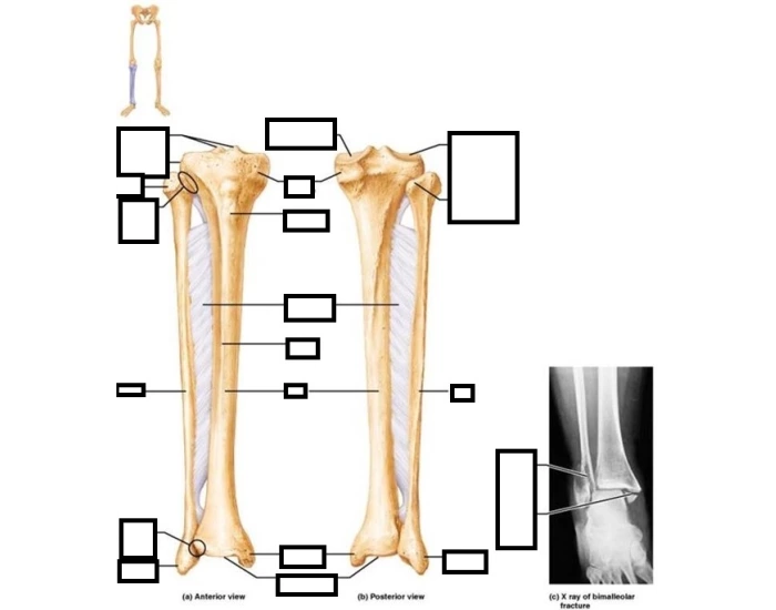 tibia and fibia Quiz