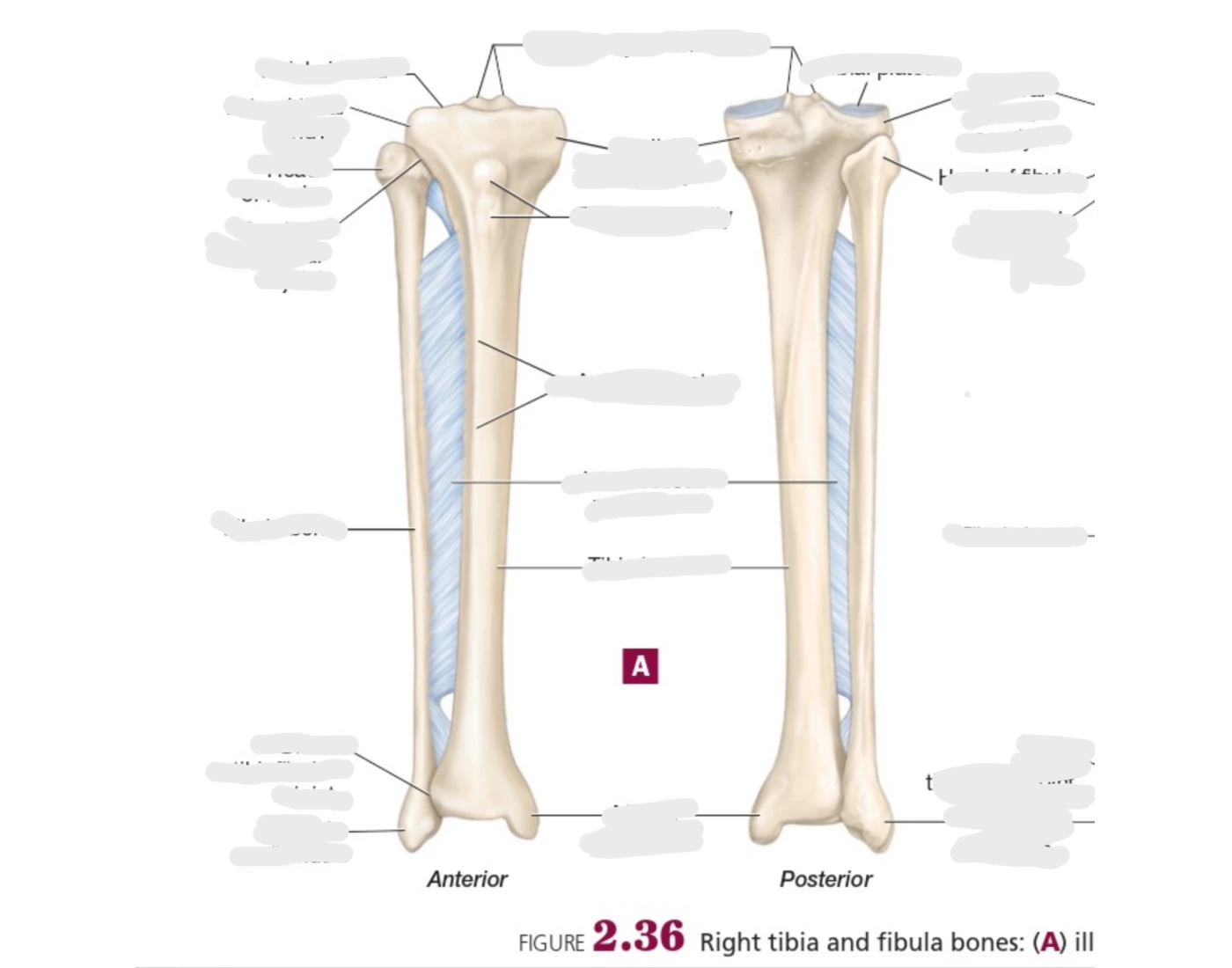 Trivia Tibia ASU Tibia and Fibula Bones Quiz