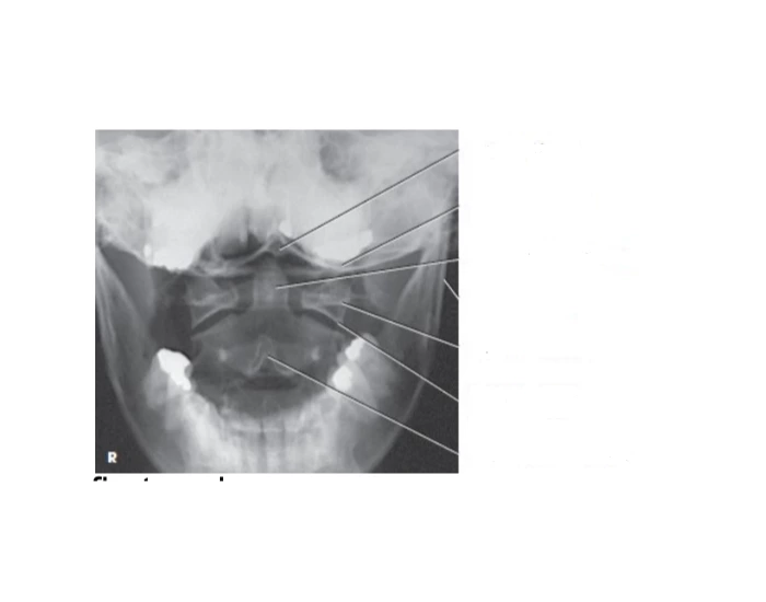 Atlas and Axis Open Mouth Quiz