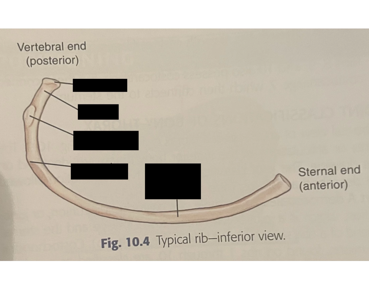 Left Rib Inferior View Typical rib-- inferior view Quiz