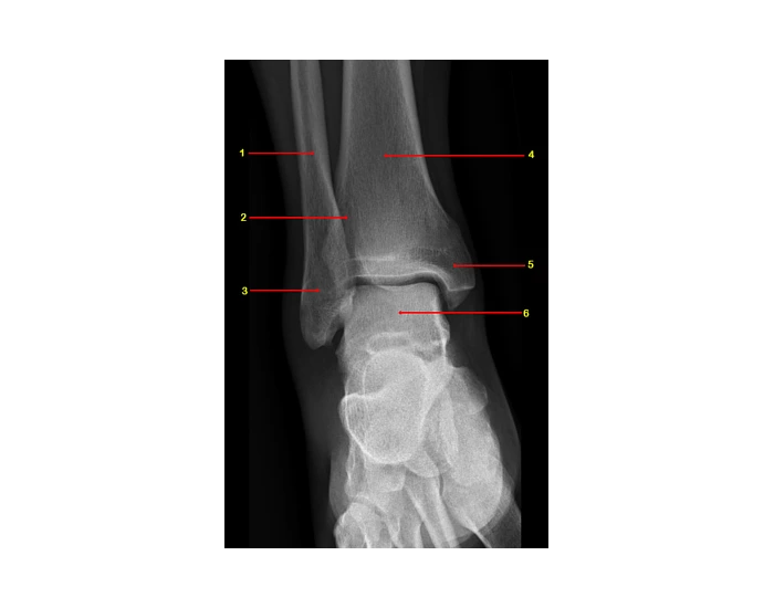 Ap Label ankle ap label Quiz