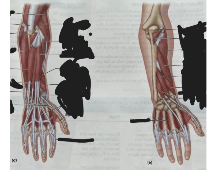 More Arm Muscles Needed Printable Worksheet