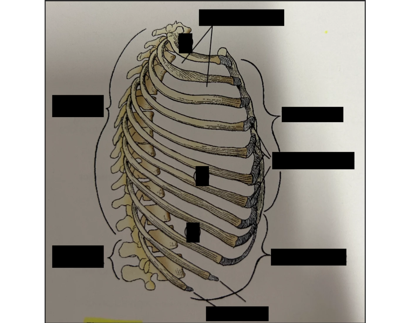 Lateral ribs Quiz