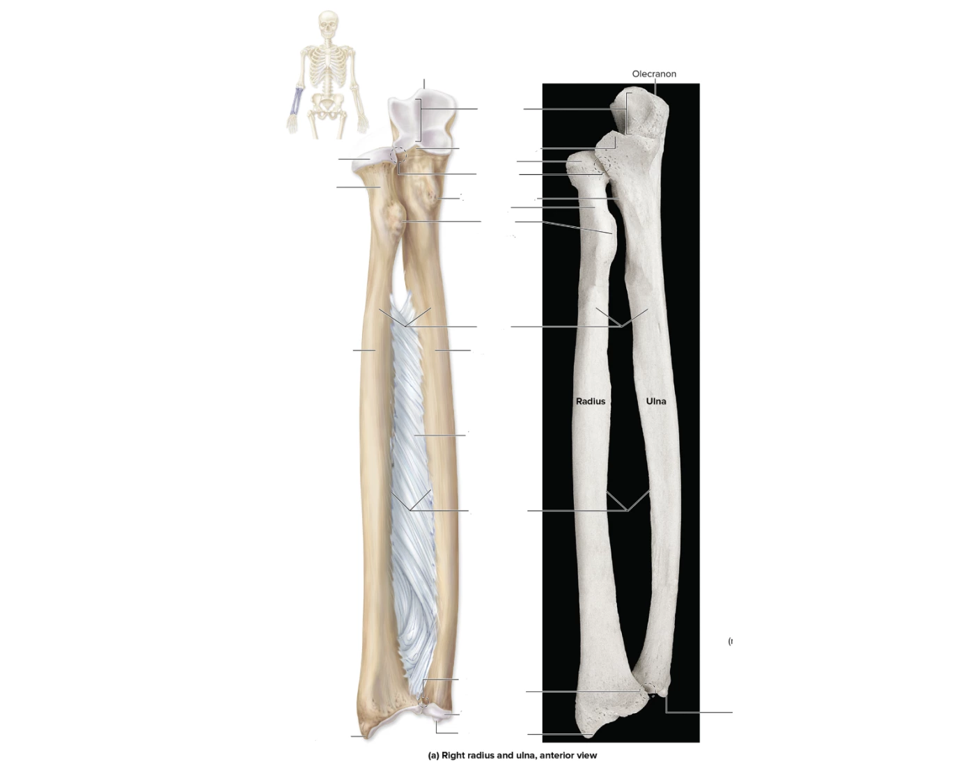 radius/Ulna Anatomy Quiz