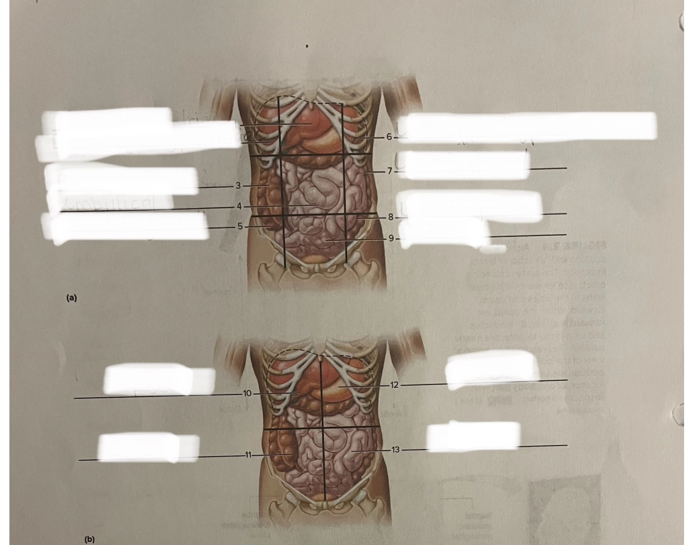 Abdominopelvic Cavity Regions and Quadrants Quiz