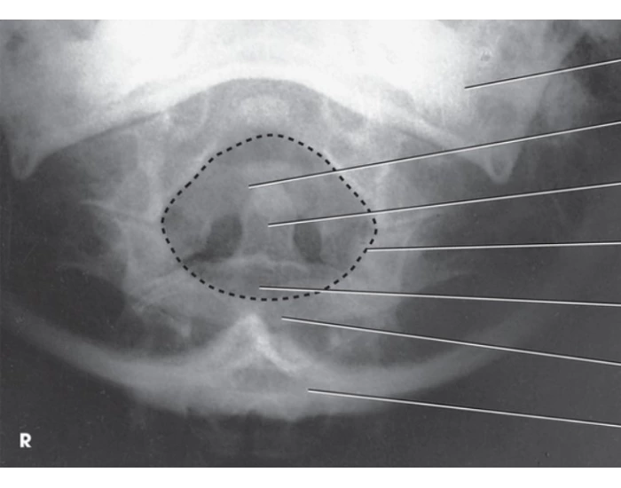 AP Dens: Fuchs Method Quiz