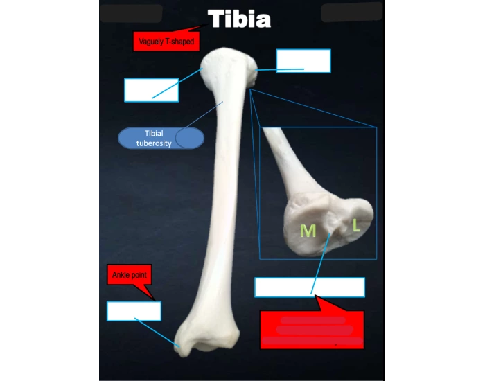 Tibia Anatomy Quiz