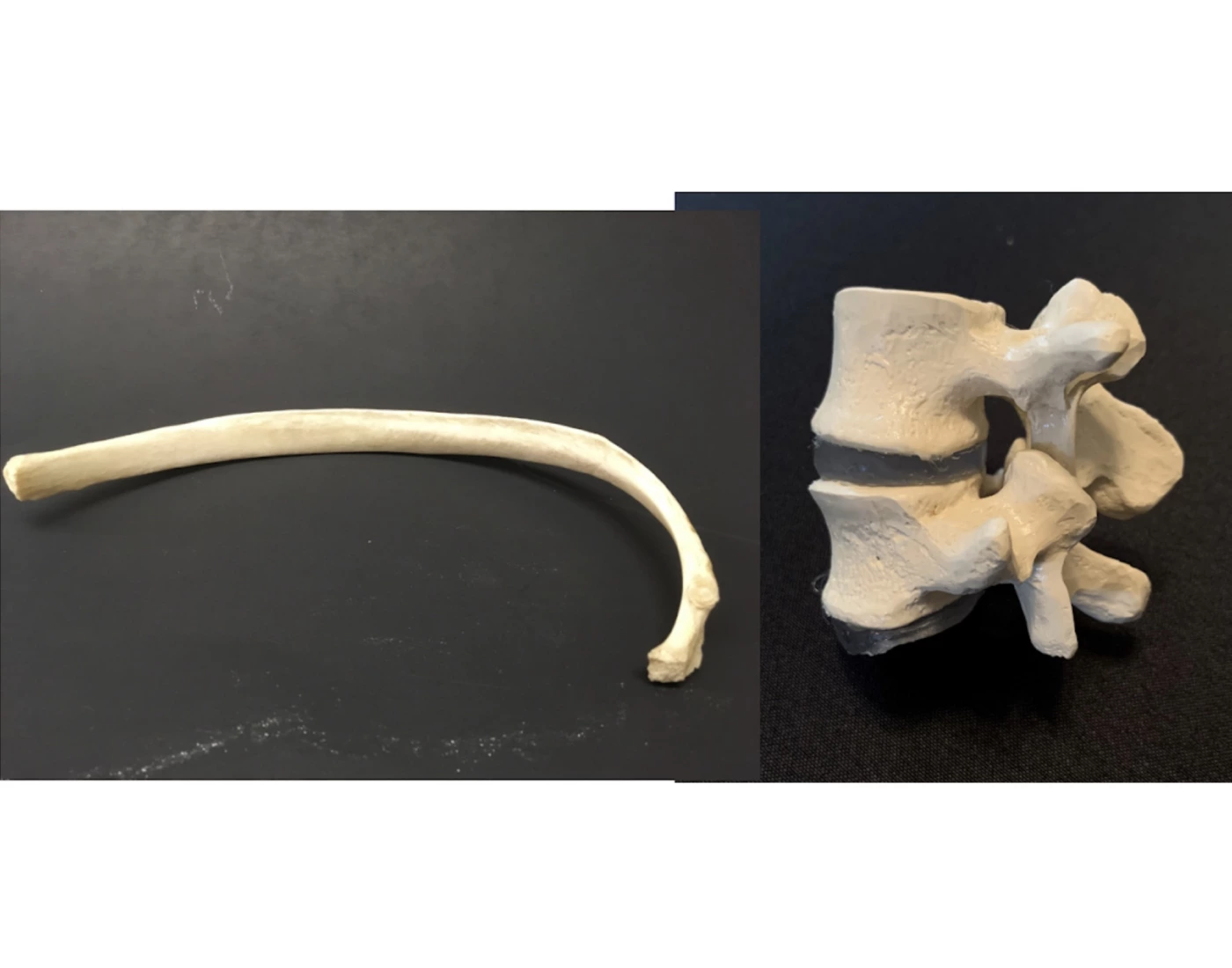rib and vertebral column labeling — Printable Worksheet