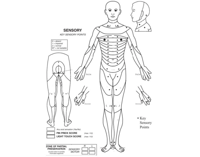 ASIA Scale Sensory Key Points Quiz
