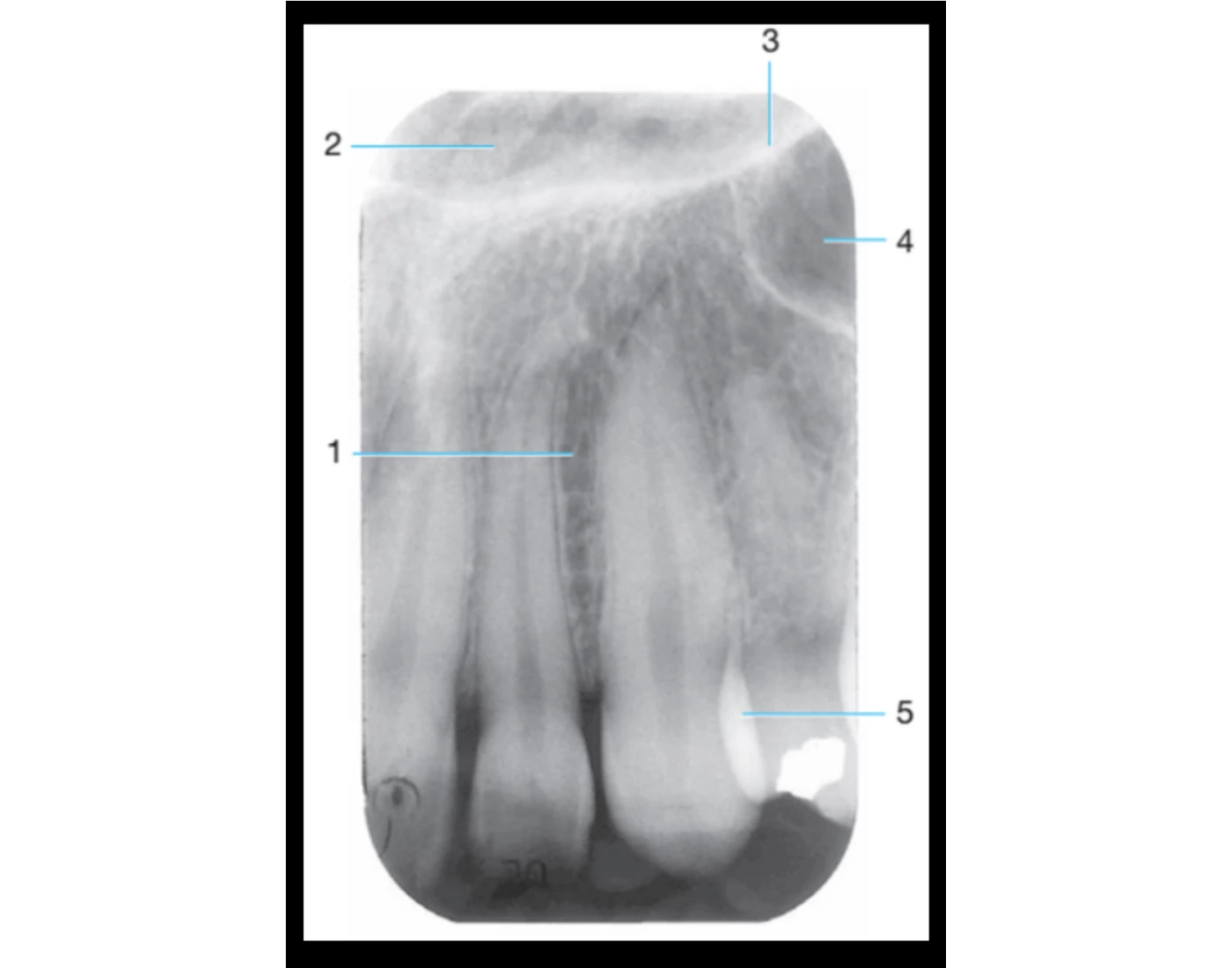 Fmx Notes Anatomy Landmarks FMX #7 Quiz