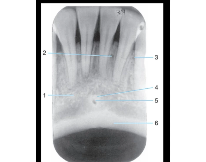Fmx Notes Anatomy Landmarks FMX Part 1 QUESTION 4 Quiz