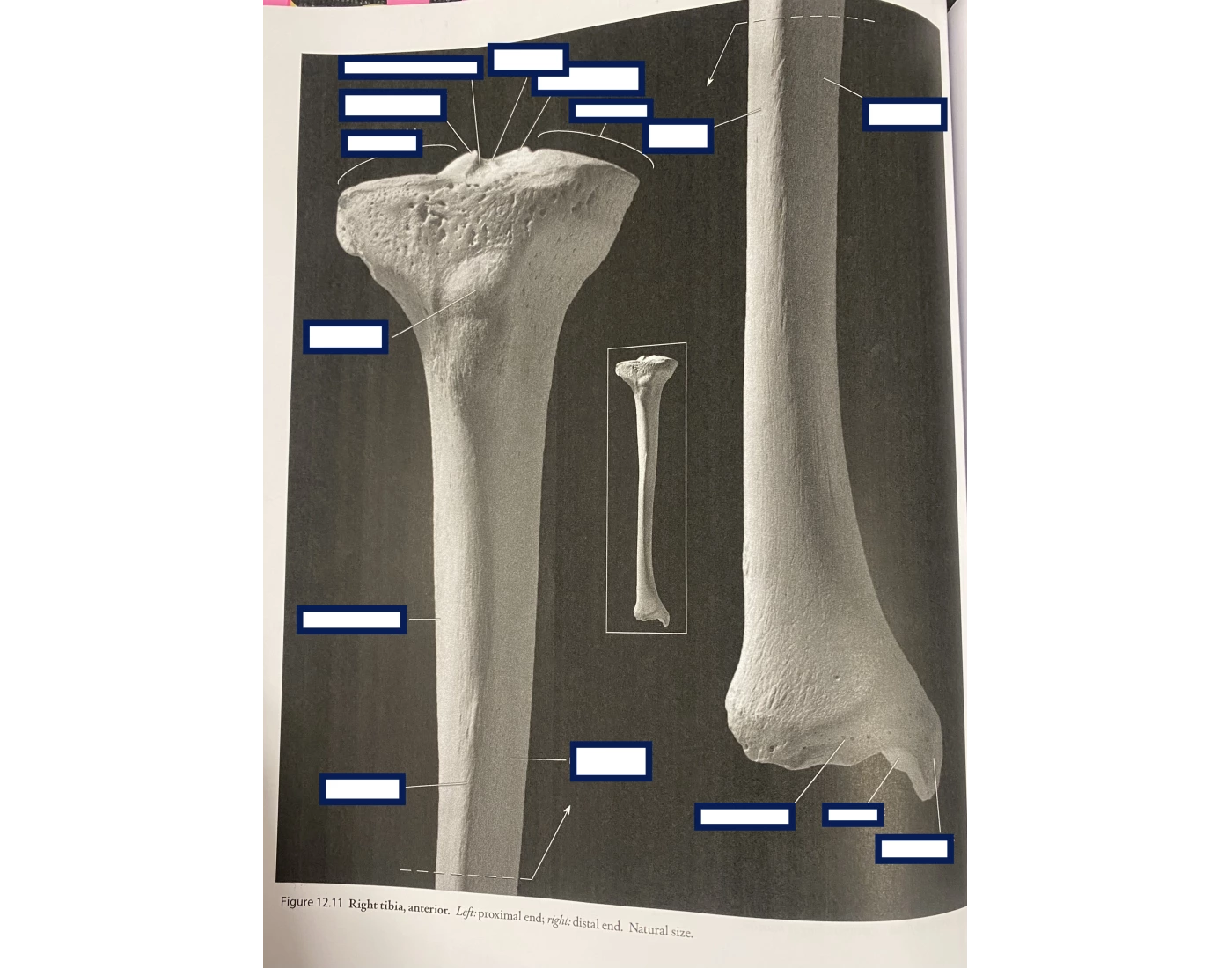 Tibia Anterior Printable Worksheet